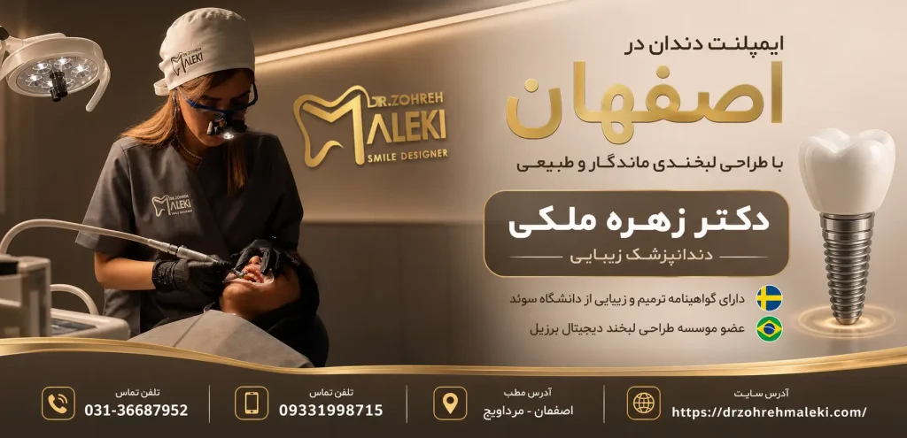ایمپلنت دندان در اصفهان