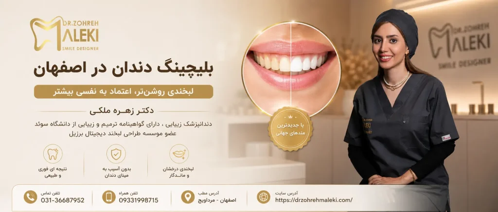 بلیچینگ دندان در اصفهان