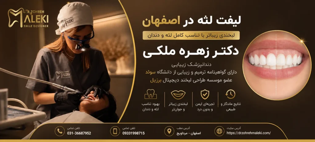 لیفت لثه در اصفهان
