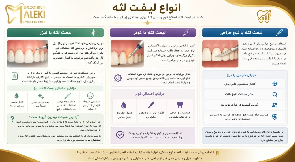 لیفت لثه در اصفهان